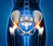 Hip Replacement Surgery Success Rate in India