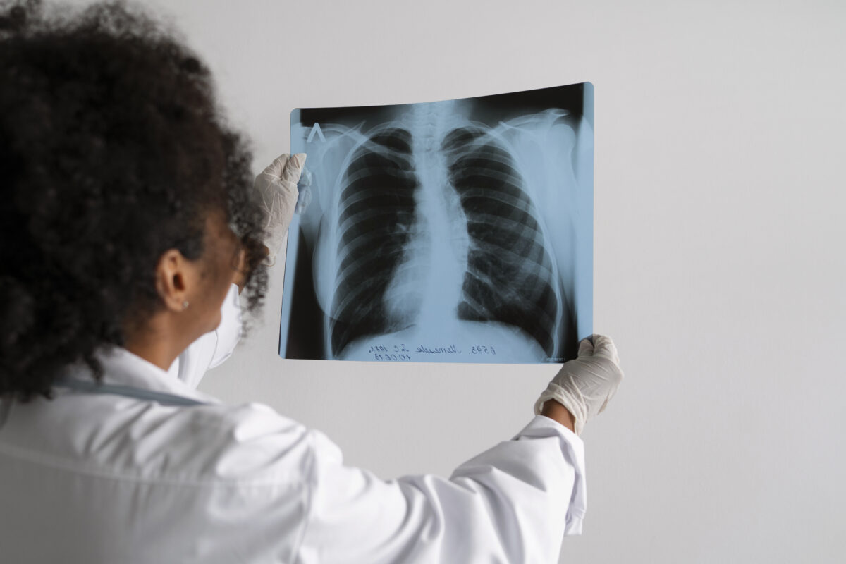 Affordable lung cancer treatment in India at top hospitals like Apollo, Medanta, and Fortis