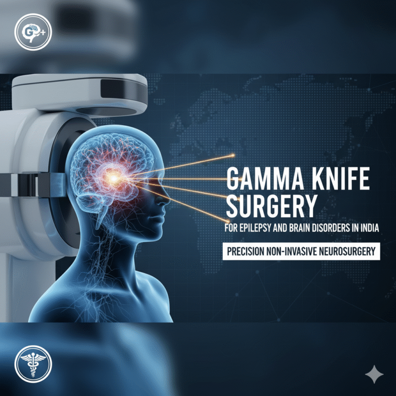 Medical illustration of a Gamma Knife device targeting a human brain with focused beams, showing the neurological pathways, with the caption “Gamma Knife Surgery for Epilepsy and Brain Disorders in India – Precision Non-Invasive Neurosurgery.”