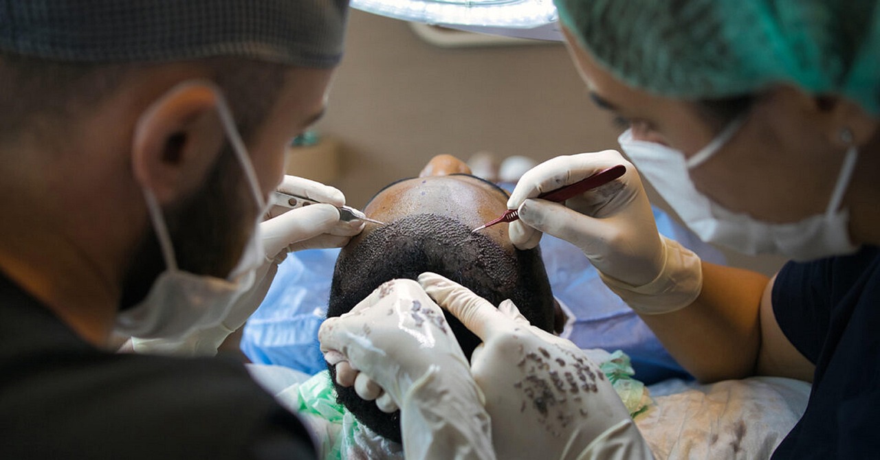 A patient consulting with a hair transplant specialist in India showing advanced technology and successful results at top-rated hospitals in 2025.