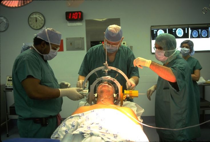 Doctors performing Deep Brain Stimulation (DBS) surgery in a modern operating theatre in India.