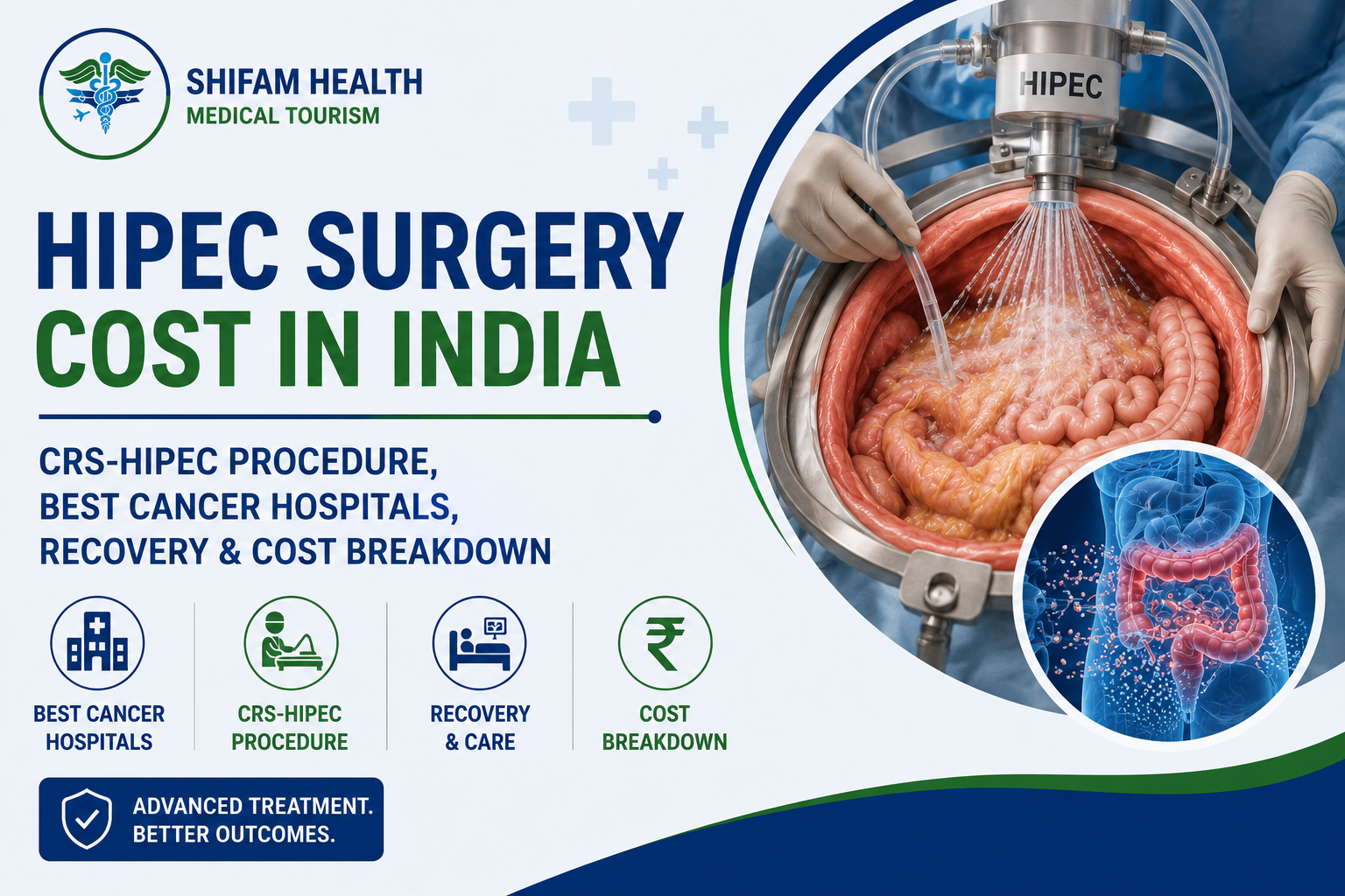 HIPEC Surgery Cost in India – Complete Guide for Patients