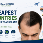 Cheapest countries for hair transplant featured image comparing affordable destinations for hair restoration with a hair transplant before-and-after concept and medical tourism.