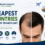 Cheapest countries for hair transplant featured image comparing affordable destinations for hair restoration with a hair transplant before-and-after concept and medical tourism.