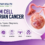 Germ cell ovarian cancer infographic showing symptoms, types, diagnosis, stages, and treatment.