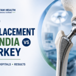 Hip replacement in India vs Turkey with implant illustration and comparison of cost, hospitals, and results.