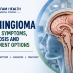 Meningioma infographic showing types, symptoms, diagnosis, and treatment options.