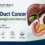 Bile duct cancer (cholangiocarcinoma) infographic showing symptoms, types, diagnosis, and treatment.