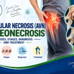 Avascular necrosis (AVN) or osteonecrosis illustration showing hip bone damage, reduced blood supply, healthy and affected hip joints, and treatment concepts.