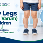 Bow Legs (Genu Varum) in Children infographic showing outward leg curvature, causes, symptoms, diagnosis, and treatment.