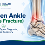 Broken ankle (ankle fracture) infographic showing symptoms, types, diagnosis, treatment, and recovery with a highlighted ankle fracture.