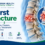 Burst fracture infographic showing symptoms, causes, diagnosis, treatment, and recovery with a highlighted fractured vertebra.