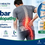 Lumbar radiculopathy infographic showing lower spine nerve compression, causes, symptoms, diagnosis, and treatment.