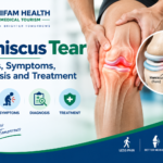 Meniscus tear infographic showing knee anatomy, causes, symptoms, diagnosis, and treatment.