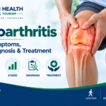 Osteoarthritis infographic showing knee joint damage, causes, symptoms, stages, diagnosis, and treatment.