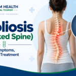 Scoliosis (crooked spine) infographic showing causes, symptoms, diagnosis, and treatment with a curved spine highlighted.