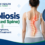 Scoliosis (crooked spine) infographic showing causes, symptoms, diagnosis, and treatment with a curved spine highlighted.