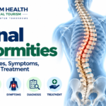 Spinal deformities infographic showing kyphosis, scoliosis, lordosis, causes, symptoms, diagnosis, and treatment.