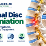 Spinal disc herniation infographic showing a herniated lumbar disc, nerve compression, causes, symptoms, diagnosis, and treatment.