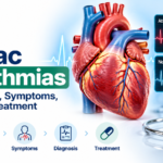 Cardiac arrhythmias infographic showing heart anatomy, ECG patterns, and treatment options.