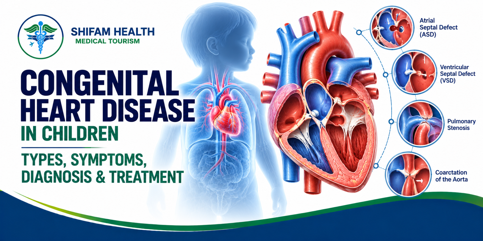 Congenital Heart Disease in Children | Shifam Health